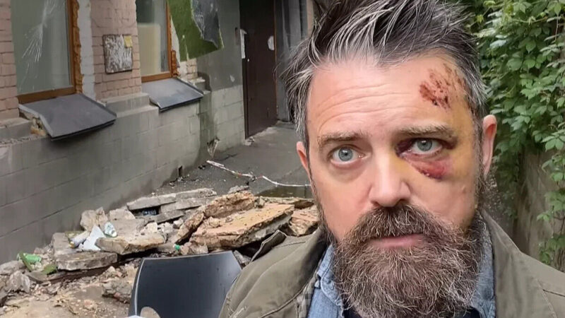 У Києві на американського режисера обвалився балкон