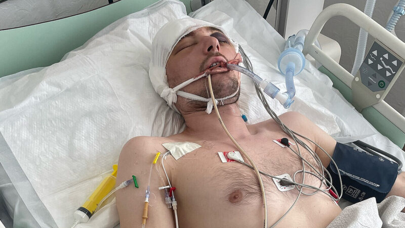 Помер чоловік з Волині, який після мобілізації опинився в реанімації