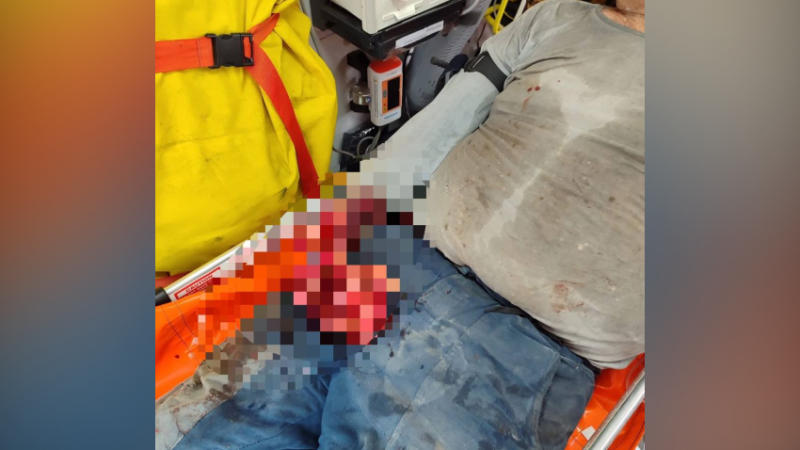 У Дніпрі чоловік втратив руку на виробництві