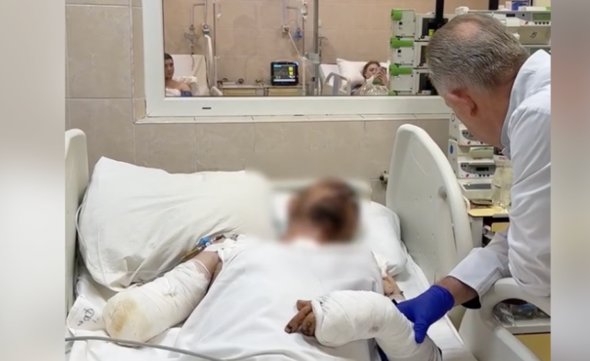 «Після поранення було видно структури мозку»: У Дніпрі врятували життя важко пораненому воїну