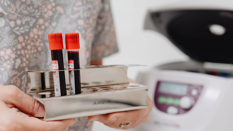 В одній із гімназій Дніпра зафіксовано спалах кору: епідемічна ситуація в області