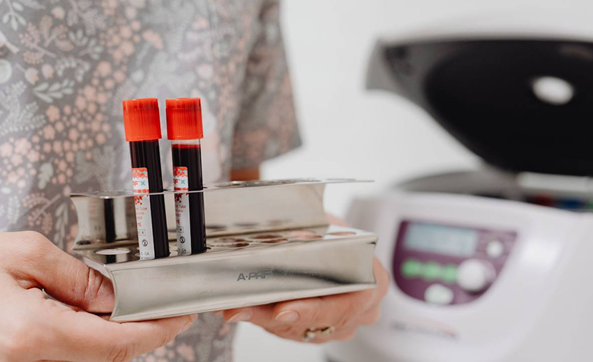 В одній із гімназій Дніпра зафіксовано спалах кору: епідемічна ситуація в області