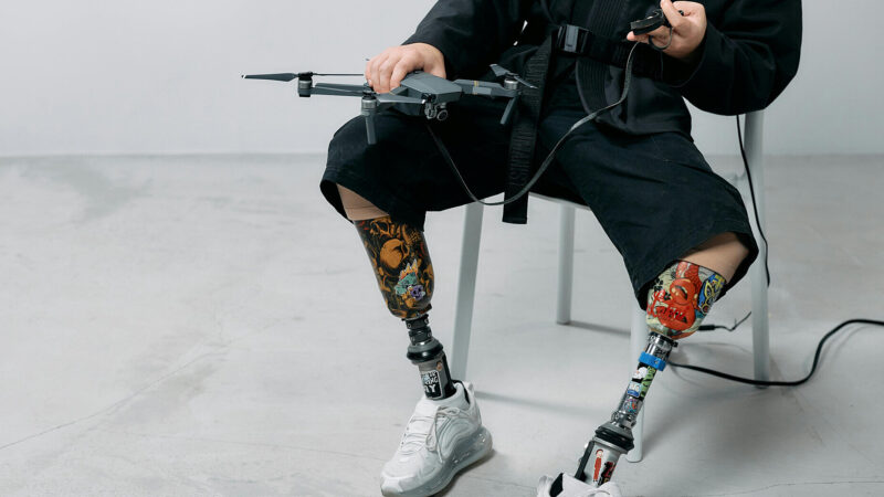 Росія нарощує імпорт високотехнологічних протезів з Німеччини – ЗМІ