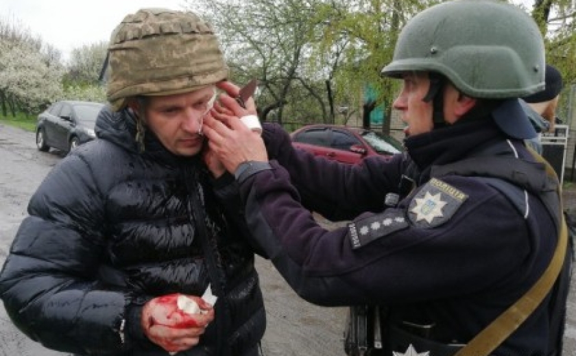 На Дніпропетровщині за останні три дні поранено 9 поліцейських