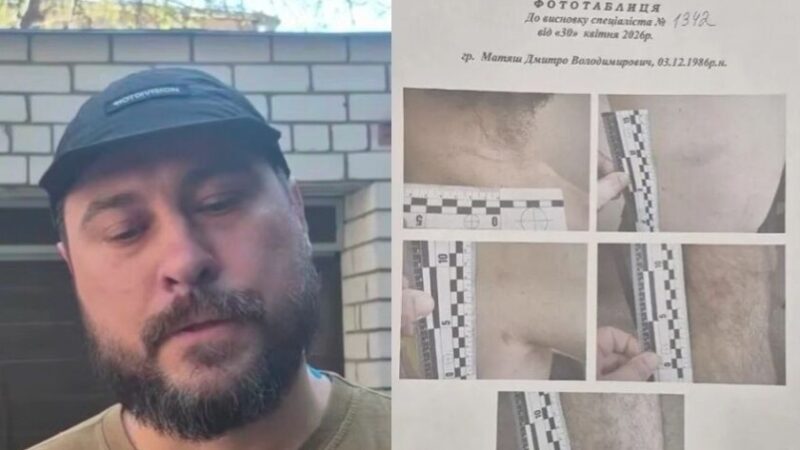 «Я стояв на колінах, і мене били як собаку»: у Дніпрі ветеран заявив про побиття представниками ТЦК: поліція відкрила провадження