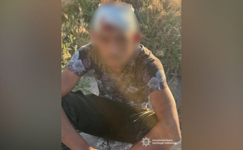 У Кривому Розі поліція затримала чоловіка за нанесення ножових поранень знайомому