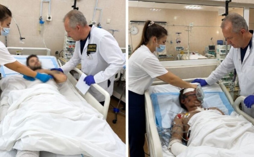 Ампутовані кінцівки та опіки: у Дніпрі рятують двох важкопоранених бійців