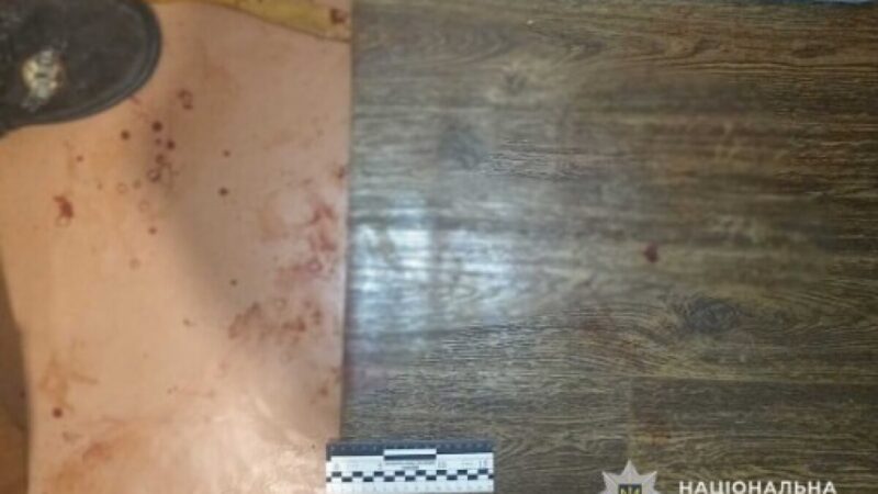 Сварка закінчилася спричиненням тяжких тілесних ушкоджень: у Нікополі правоохоронці затримали нападника