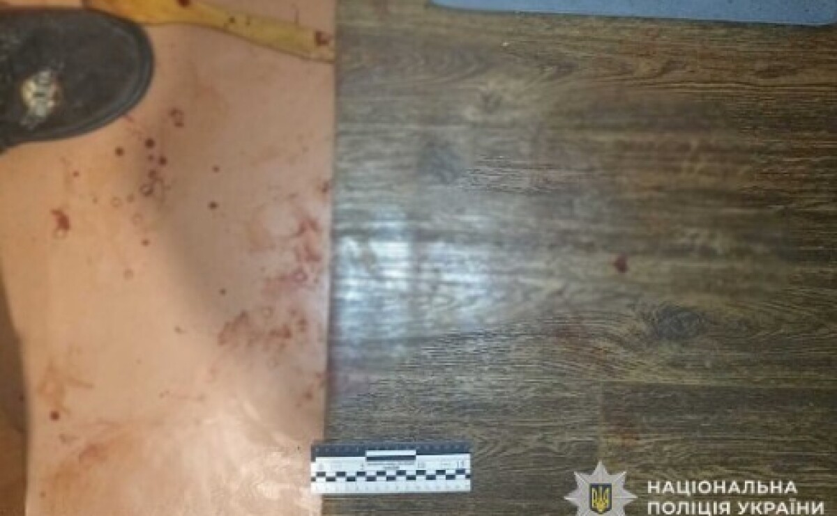 Сварка закінчилася спричиненням тяжких тілесних ушкоджень: у Нікополі правоохоронці затримали нападника