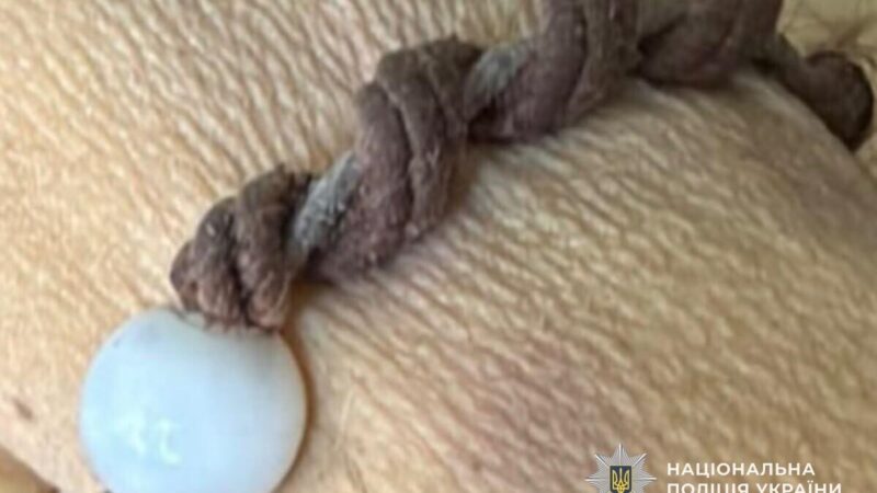 У Дніпрі знайшли тіло жінки: поліція просить допомогти встановити її особу